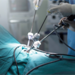 Minimally Invasive Surgery