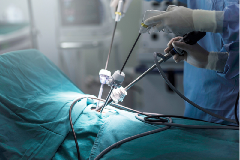 Minimally Invasive Surgery