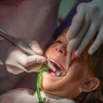 Pediatric Root Canal Experience for Kids