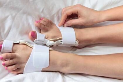 When Is Bunion Surgery Necessary
