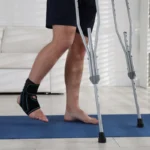 Ankle Replacement