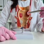 Hemorrhoid Removal Surgery