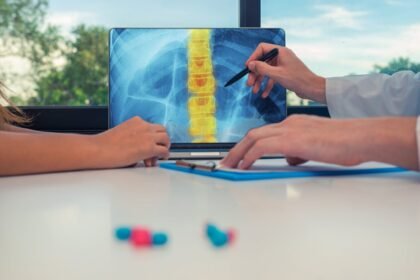 Recovery Process from a Herniated Disc